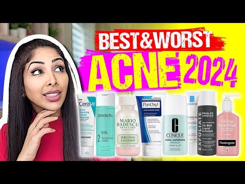 BEST & WORST Acne Solutions: DOCTOR V Reveals