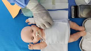 COLOCAR BOLSA DE COLOSTOMIA EN NEONATOS - CUIDADOS DE ENFERMERIA