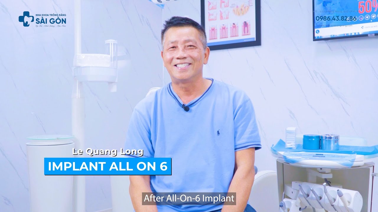 Implant all on x - have a new teeth after 48 hours
