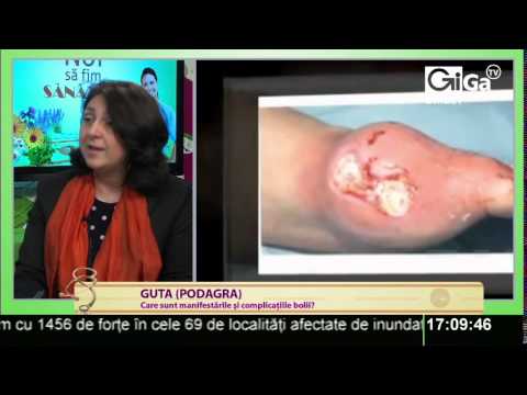 Artroza simptomelor și tratamentului articulației degetului mare