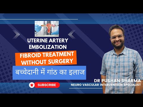 Uterine Artery Embolization | Dr. Pushan Sharma 