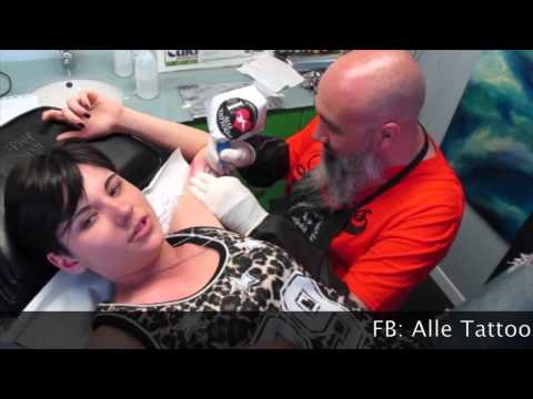Controindicazioni per fratture dellanca Imaging del rachide cervicale Naberezhnye Chelny