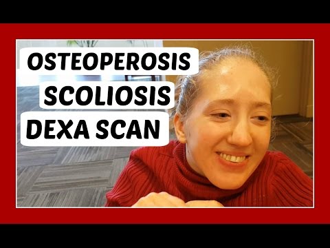 Watch lagu Images Videos Cerebral Palsy Osteoporosis, Watch Images Cerebral Palsy Osteoporosis free Watch Images, Watch Images Cerebral Palsy Osteoporosis