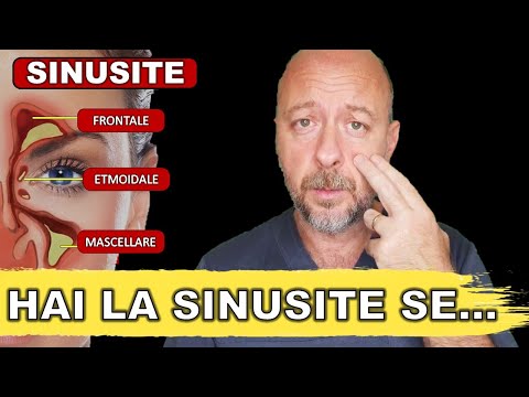 Hai la SINUSITE se... tutti i SINTOMI e quando preoccuparsi!!