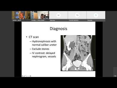 UW Urology Grand Rounds: "UPJ Management" – 2/2/2022