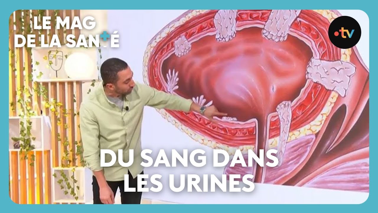 Cancer de la vessie : les signes qui doivent alerter