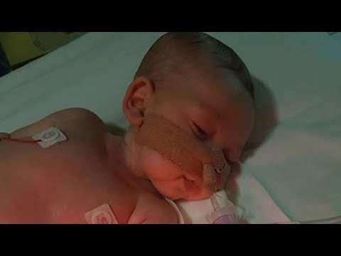 Arab Today- 48 hours to decide baby Charlie Gard’s life