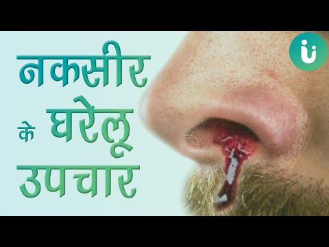 कैसे रोके नाक से खून आना | नकसीर के घरेलू उपचार | How to stop nose bleeding.