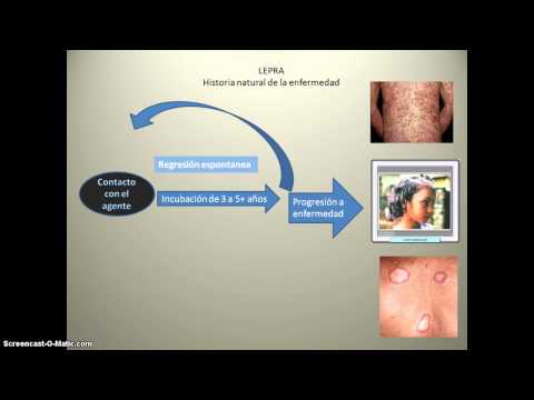 historia natual de la lepra