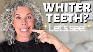 I Bought the Best-Selling Teeth Whitening Kit on Amazon & Tried It At Home. Did it REALLY Work?