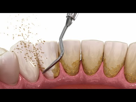 IGIENE ORALE PROFESSIONALE