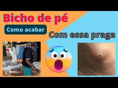 Bicho de pé como acabar com essa praga