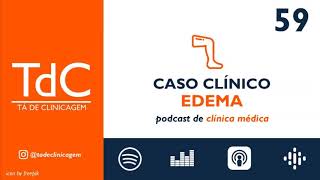 Edema: Como investigar? - Caso Clínico: Episódio 59