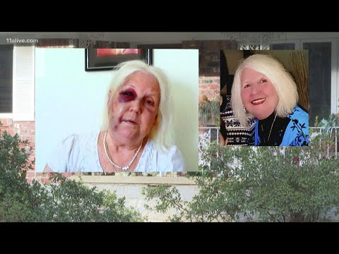 Beaten and robbed in her own home, metro Atlanta woman asking for help finding attacker