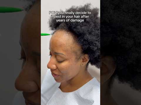 POV You Finally Decide to Invest in Your Hair! #hairgrowth #hairlosssolution