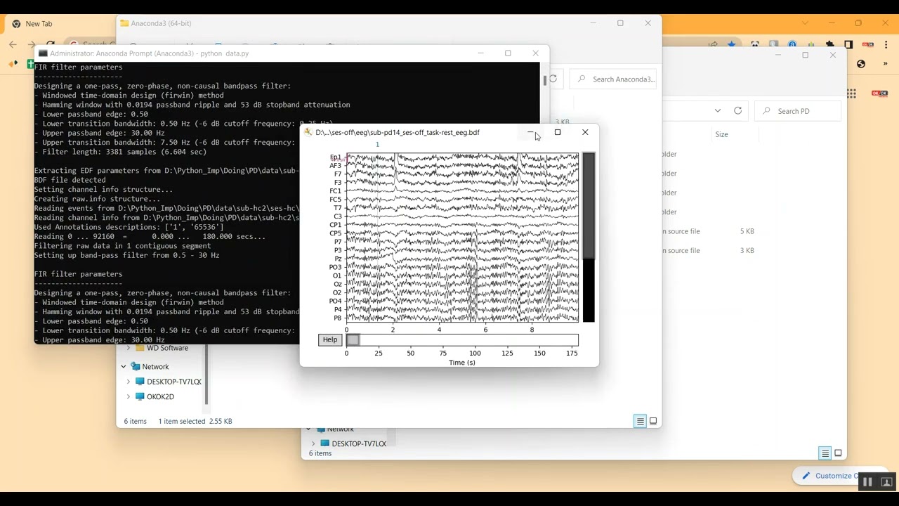 Fall Risk Prediction in Parkinson's Disease Using Real World Inertial