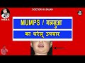 Mumps Ka Gharelu Ilaj | गलसुआ, कनफेड का इलाज