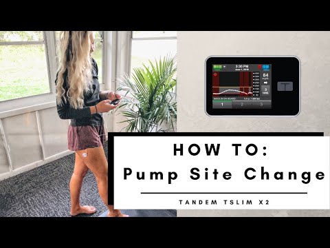 How To: Insulin Pump Insertion (Tandem Tslim 2x)