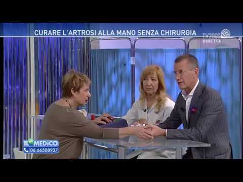Gonfiore delle articolazioni delle mani da fare Trattamento di artrite artrosi al ginocchio farmaci