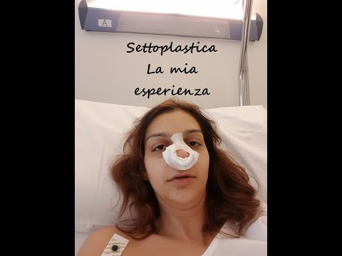 SETTOPLASTICA _ VI RACCONTO LA MIA ESPERIENZA