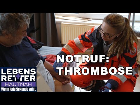 Notfall: Thrombose-Alarm – Patient hat extreme Schmerzen! | Lebensretter hautnah | SAT.1