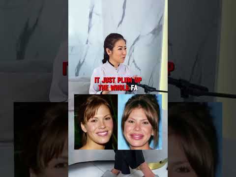 Dermal Filler vs Collagen Filler – What’s the Difference? | Best Injectable for Facial Volume