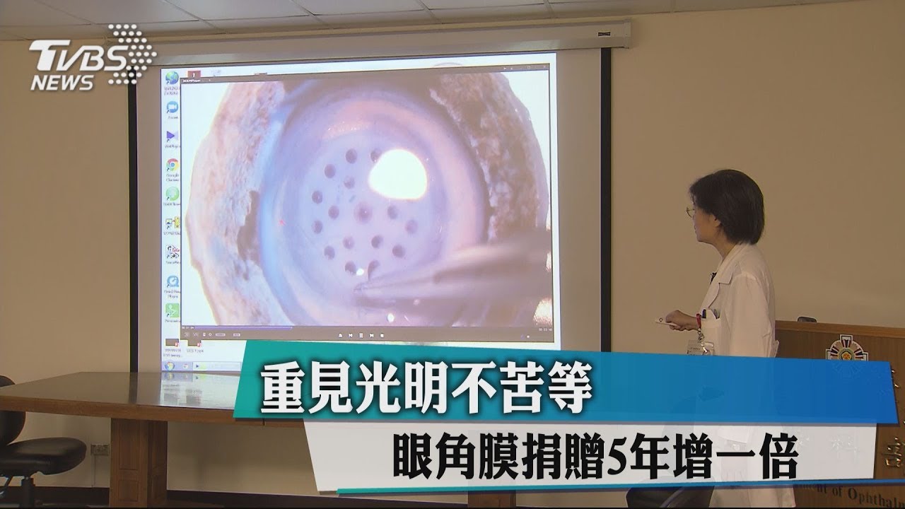 重見光明不苦等 眼角膜捐贈5年增一倍