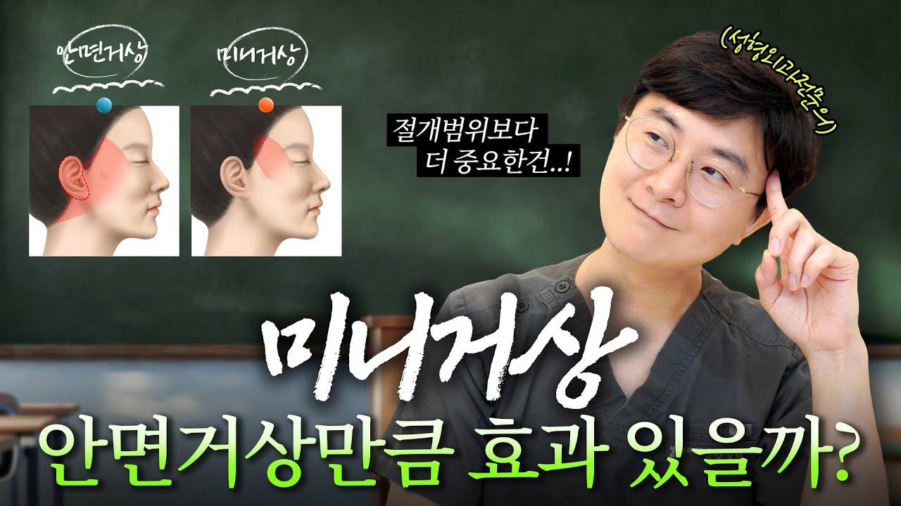 안면거상 양성혁 - [미니거상 진짜 효과 있나요? 안면거상과 차이 총 정리!????]