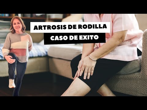 ARTROSIS DE RODILLA CASO DE EXITO