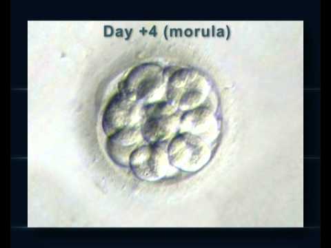 Les différentes étapes du développement de l'embryon en FIV