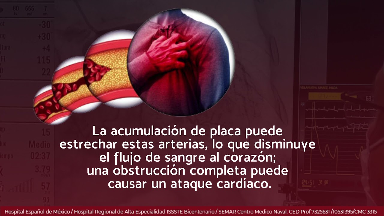 Marcelo Utrera Lagunas-122