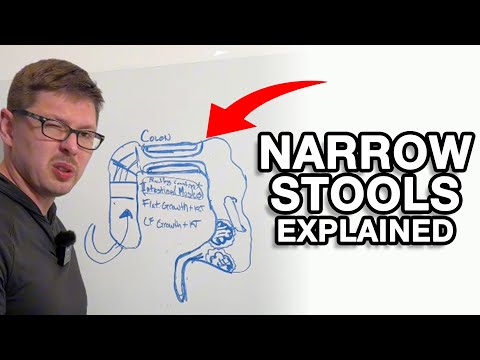 What causes a pencil stool or narrow stool?