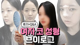 EDITION TV - 여자 코 성형 브이로그 (잔잔함 주의) | 후기+Q&A