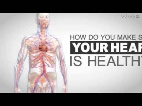 Video preview: WIWE – Stroke Risk Product