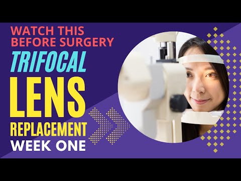 LENS REPLACEMENT SURGERY WEEK 1 - An honest review