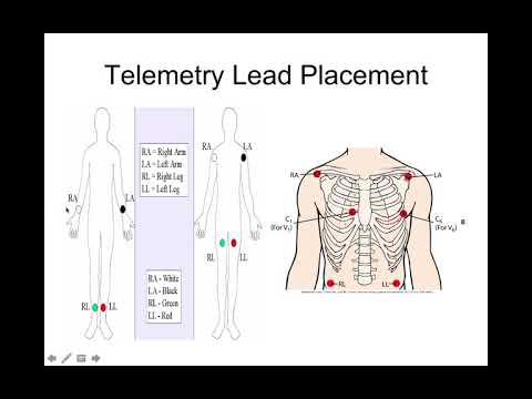 Basic ECG's For Nursing and Paramedic Students