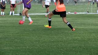 OCD Knee Diagnosis - Scottish Rite for Children Sports Medicine