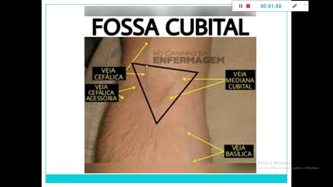 Aula J - parte 04 - Técnicas Básicas - Reab. I - ITENS - sist. Circ. e Drenos