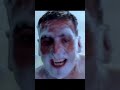 Kya Hua Jab Akshay Kumar Ki Aankh Me Gya Sabun