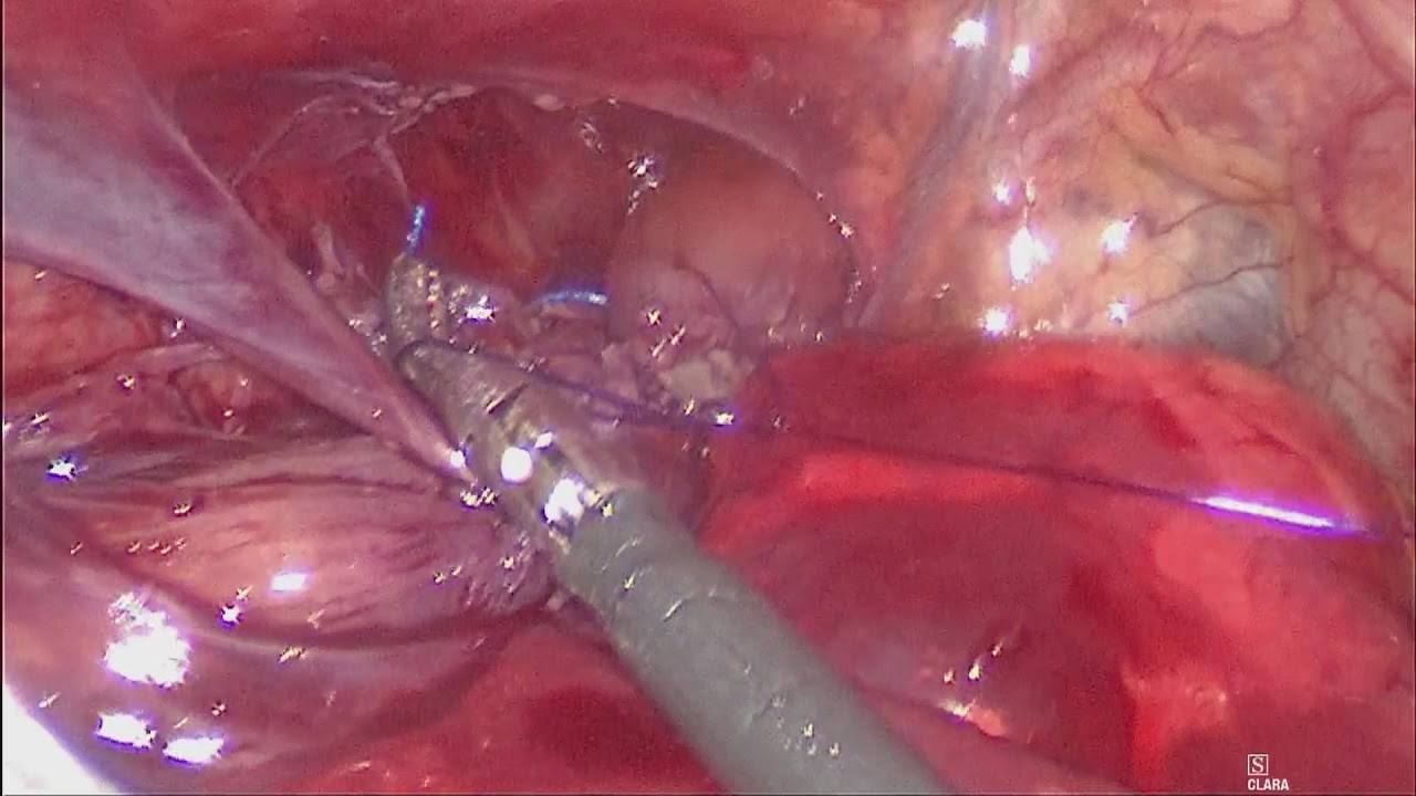 Luis Ricardo García Vázquez-4