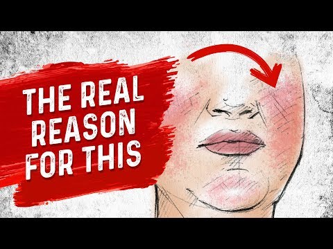 Why PROTEIN Does Not Help Hair Loss Brittle Nails and Collagen Loss – Dr Berg