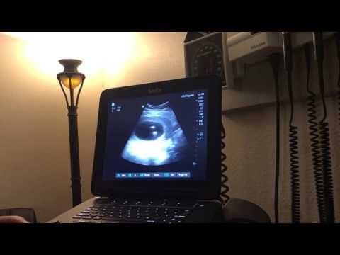 16 week gender anomaly scan ❤️