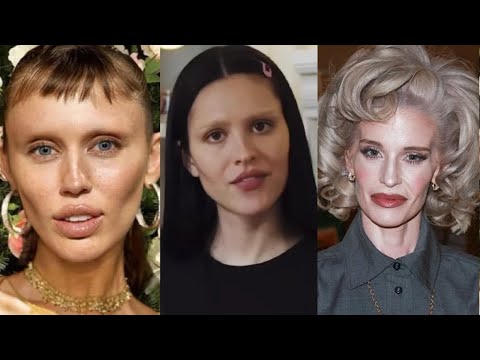 You Won’t Believe How BAD These Celebs Look Now