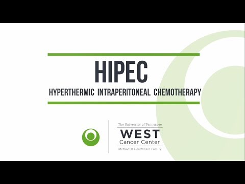 HIPEC Procedure - West Cancer Center
