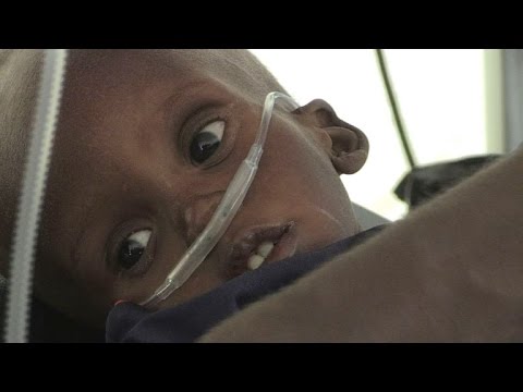Millionen Kinder hungern in Nigeria