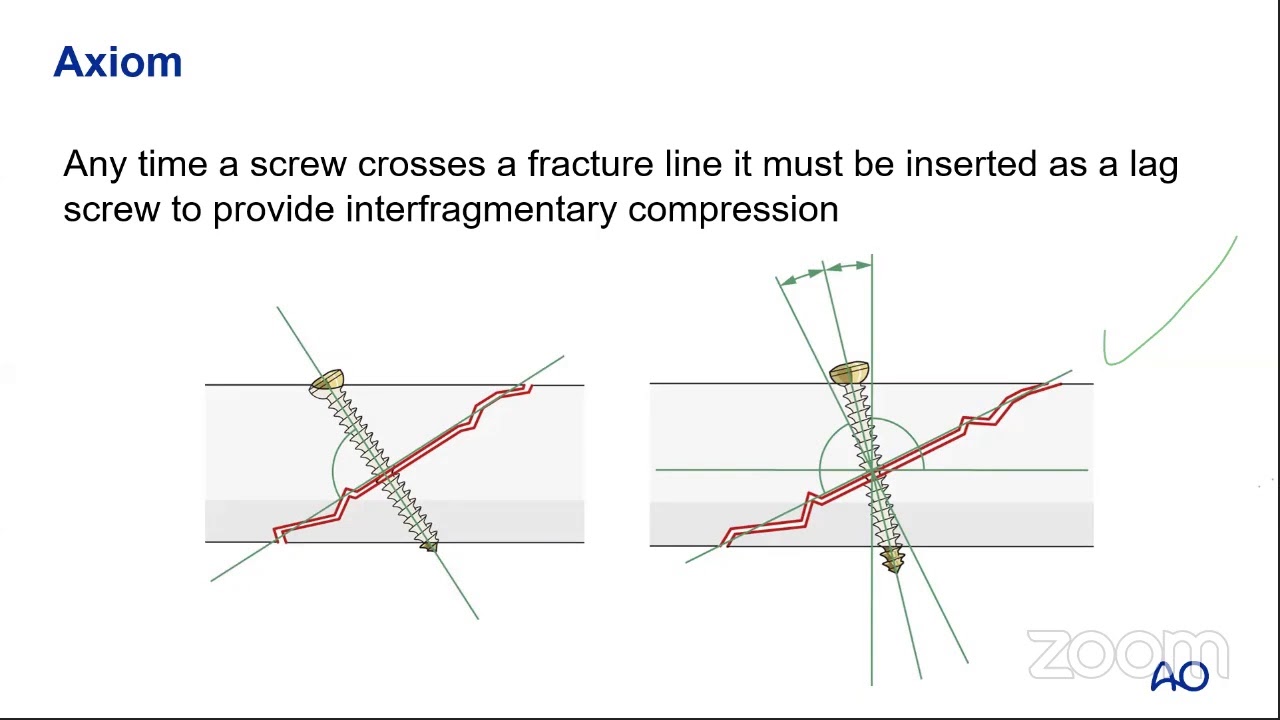 Basic Sciences S6: Absolute Stability