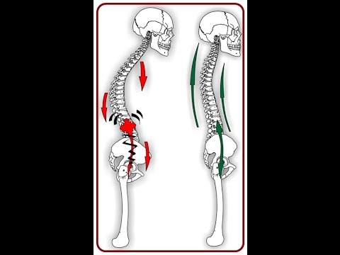 Vorbereitungen für die Gelenke bei Pferden Schmerzen im Rücken der physikalischen Behandlung von Lasten