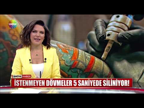 PicoWay Yeni Nesil Dövme Silme İşlemi Resim
