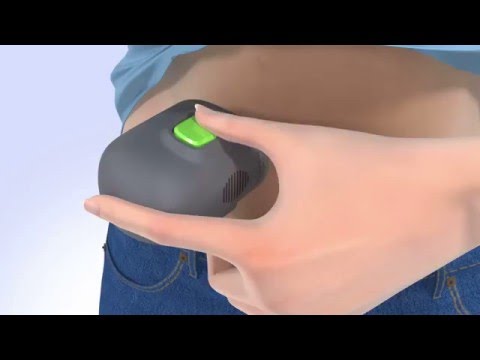 Verfahren zur Verringerung des Blutinsulin Verletzt stark meine Beine Diabetes