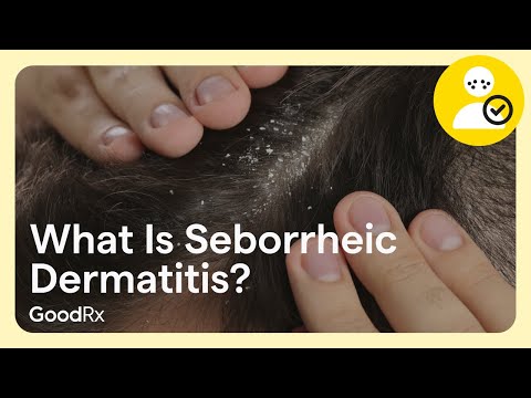What Is Seborrheic Dermatitis and How Is It Different From Dandruff? | GoodRx